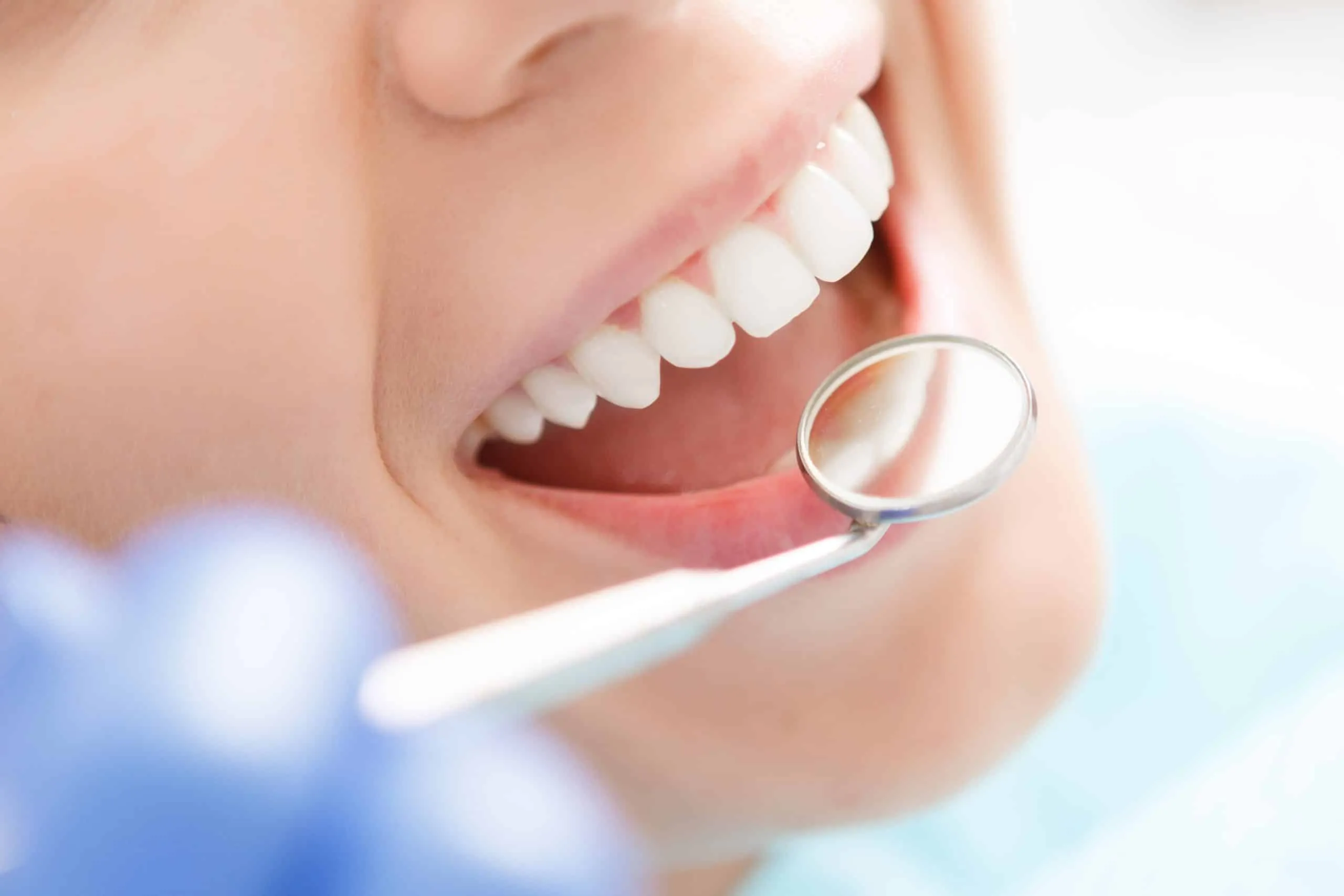 Close-up of a healthy white smile during a dental examination